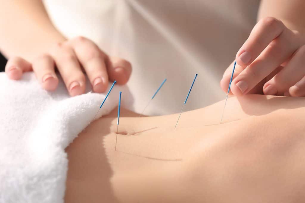 How Long Does It Take for Acupuncture to Work?