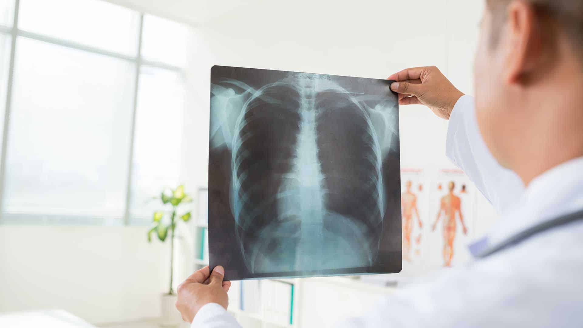 Male radiologist looking at lungs radiography, view over the shoulder
